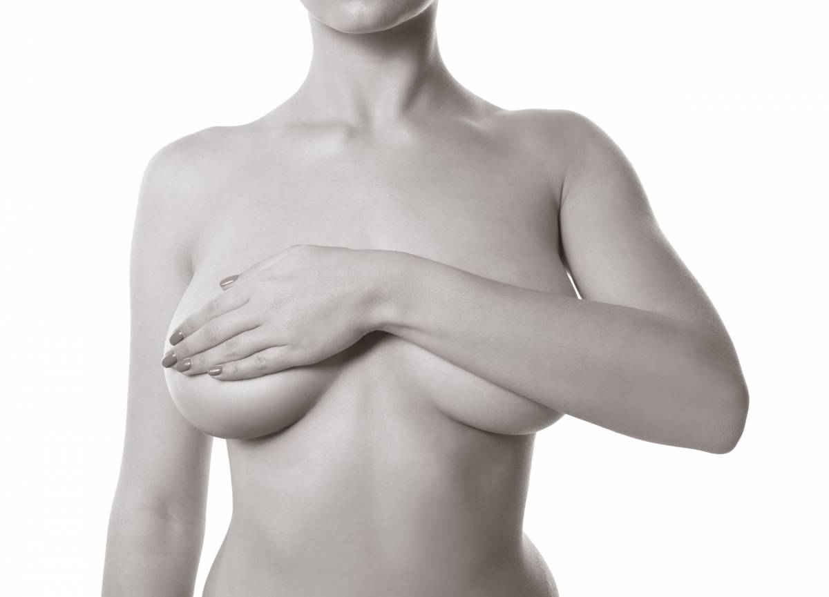  chirurgie lifting des seins - Dr Hamou