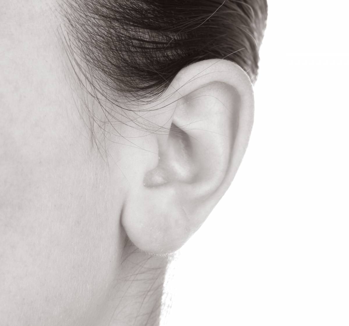 Opération esthétique oreille lobes fendus - Dr Hamou