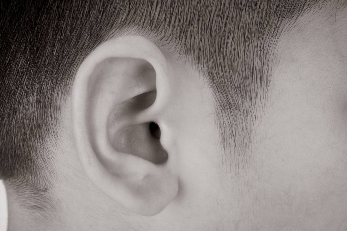 Otoplastie pour oreilles décollées - Dr Hamou