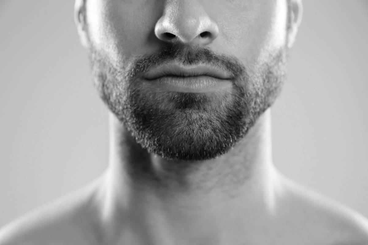 Greffe de barbe - Dr Hamou