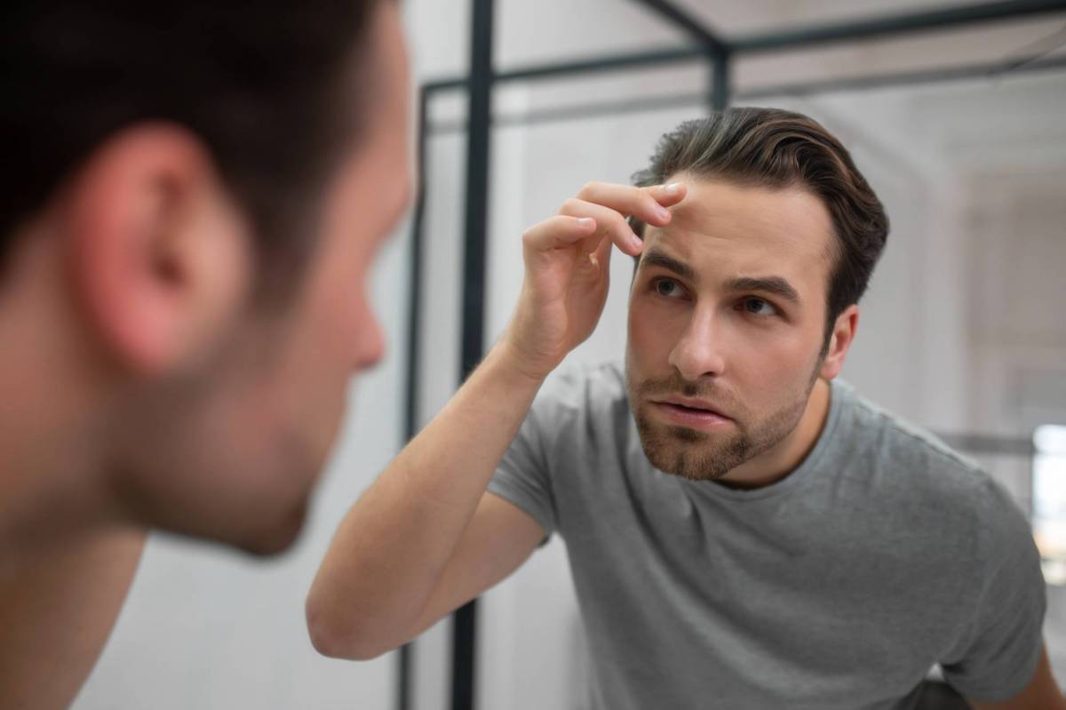 Pourquoi la calvitie ne discount touche que les hommes