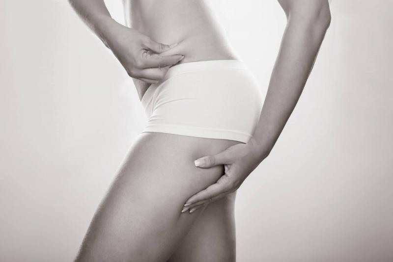 Liposuccion des jambes - Dr Hamou