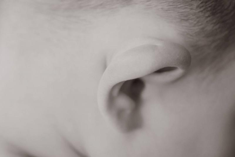 Chirurgie esthétique des oreilles - Dr Hamou